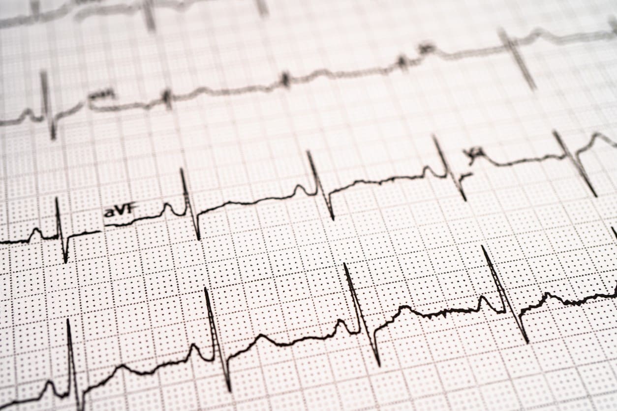 Potential of Hexarelin Peptide in Cardiovascular Health